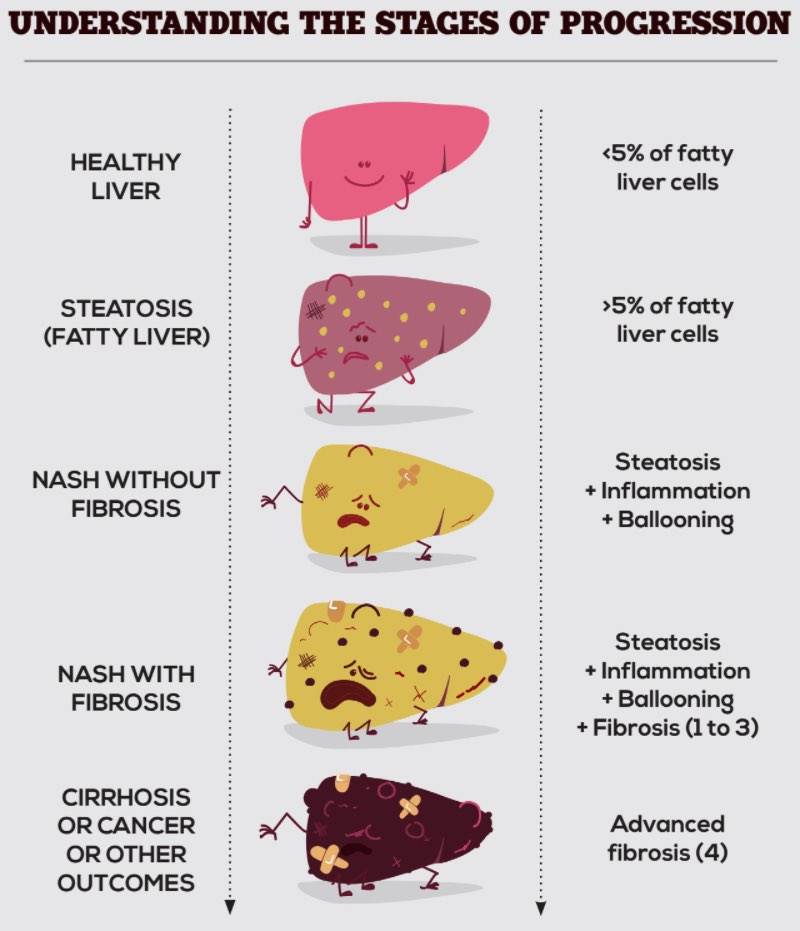 Liver Health.