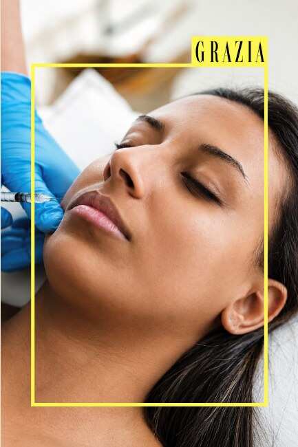 Baby Botox: Everything To Know About The Subtle Alternative To Botox
